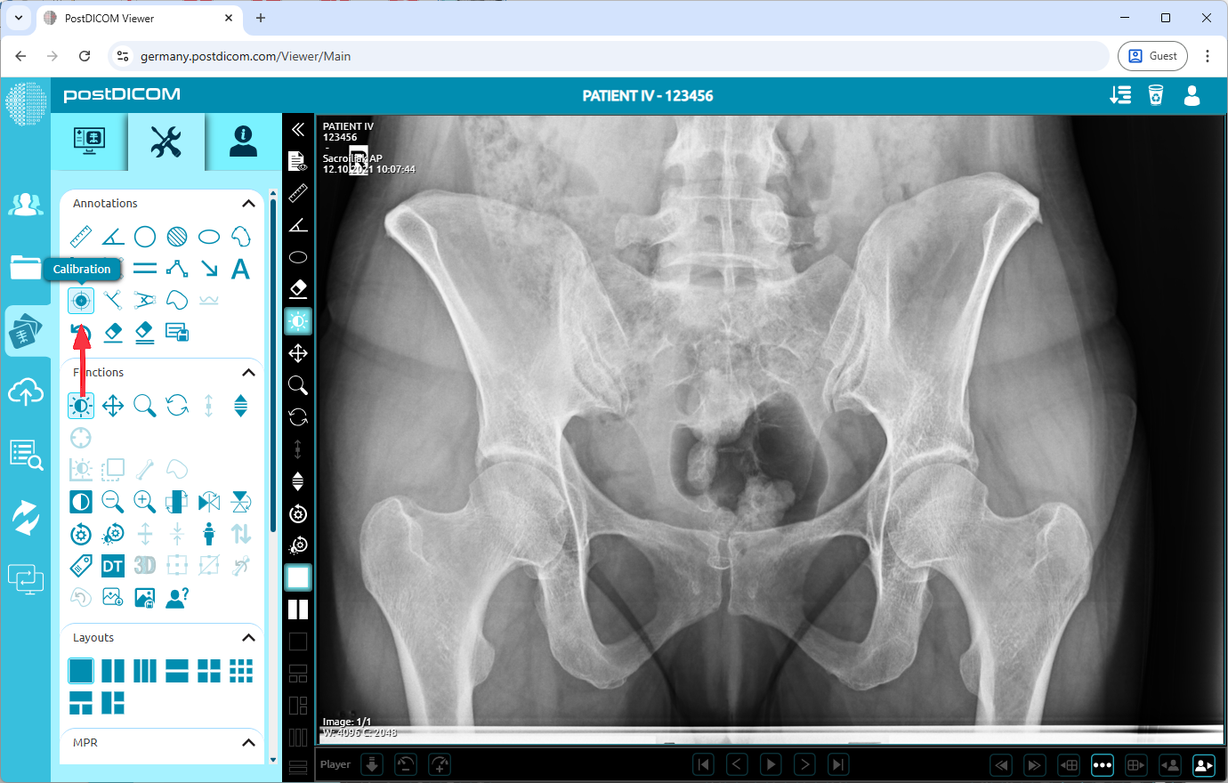 Using Calibration Tool